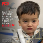 I'm From Skardu & I Was Born With A Hole In My Heart